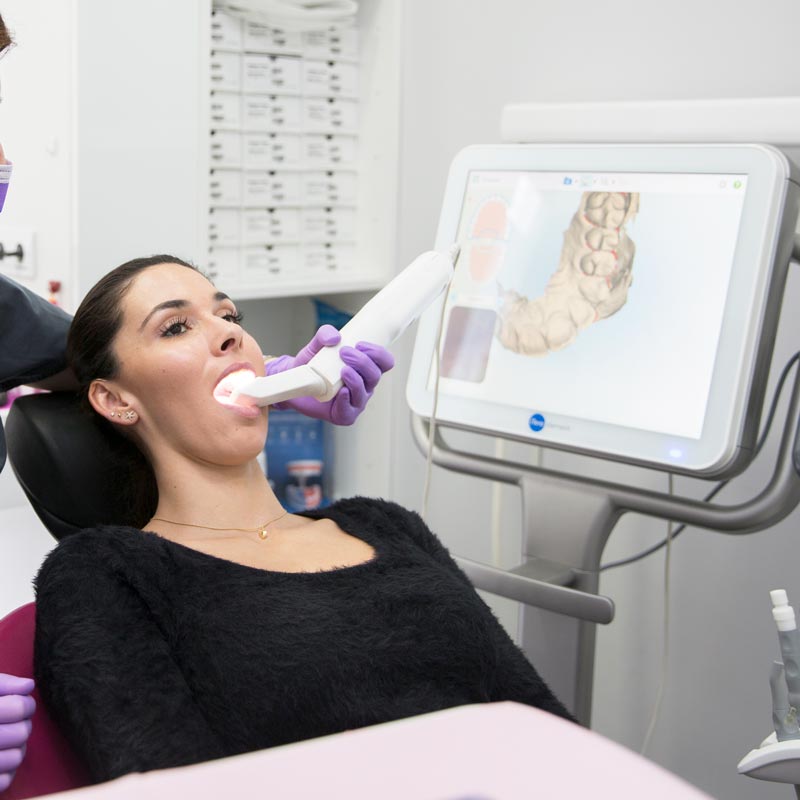 escaner entreoral Espacio Dental Prado & Aycart clínica dental