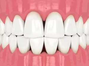 tronera dental